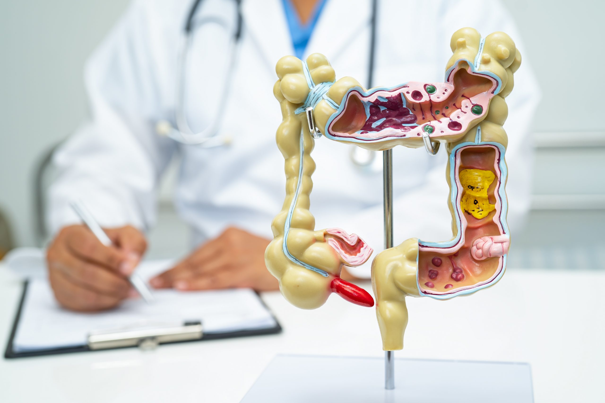 Vortrag: Darmerkrankungen erkennen und behandeln